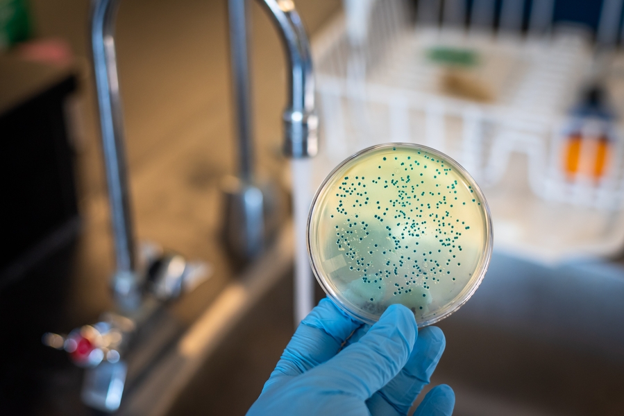 microbiology-research-petri-dish-examined-under-la-2026-01-06-08-54-49-utc